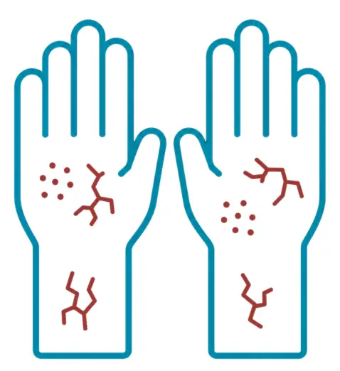 Skin Conditions 1
